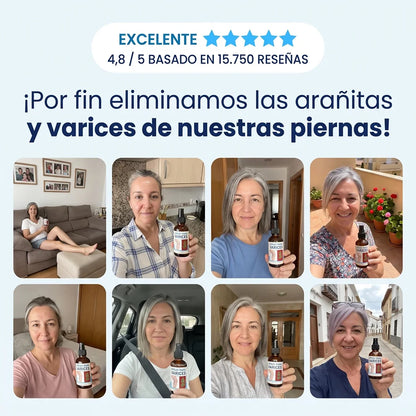Spray de Crioterapia para Eliminar la Aparición de Varices y Arañitas